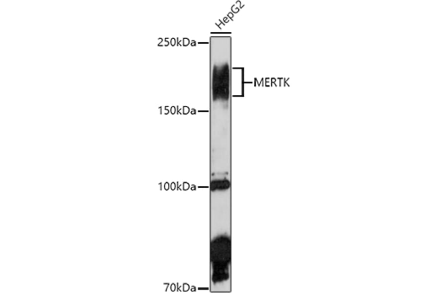 Western Blot - Anti-MERTK Antibody (A11835) - Antibodies.com
