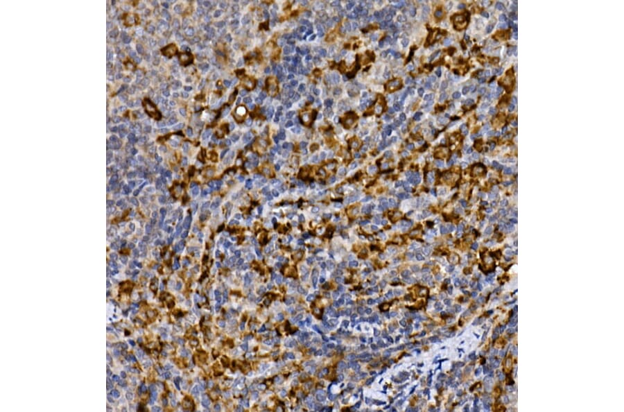 Immunohistochemistry - Anti-MERTK Antibody (A11835) - Antibodies.com