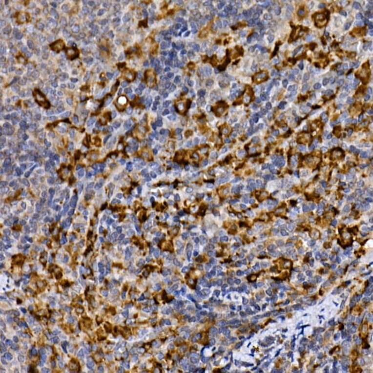 Immunohistochemistry - Anti-MERTK Antibody (A11835) - Antibodies.com