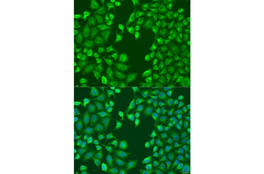 Immunofluorescence - Anti-MERTK Antibody (A11835) - Antibodies.com