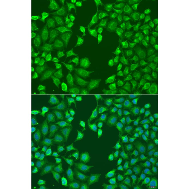 Immunofluorescence - Anti-MERTK Antibody (A11835) - Antibodies.com