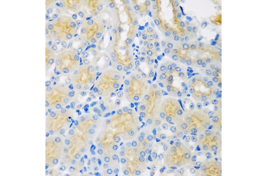 Immunohistochemistry - Anti-CYP4A11 Antibody (A5459) - Antibodies.com