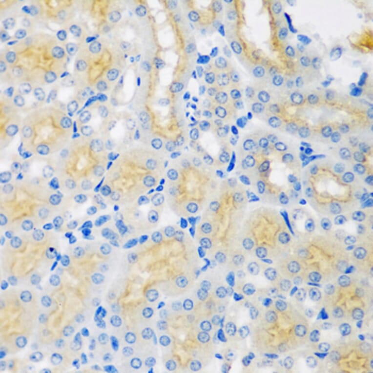 Immunohistochemistry - Anti-CYP4A11 Antibody (A5459) - Antibodies.com