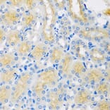 Immunohistochemistry - Anti-CYP4A11 Antibody (A5459) - Antibodies.com