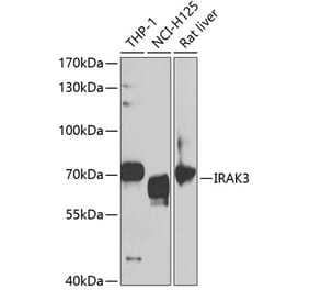 Western Blot - Anti-IRAKM Antibody (A11837) - Antibodies.com
