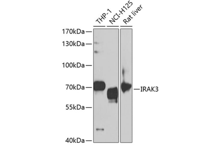 Western Blot - Anti-IRAKM Antibody (A11837) - Antibodies.com