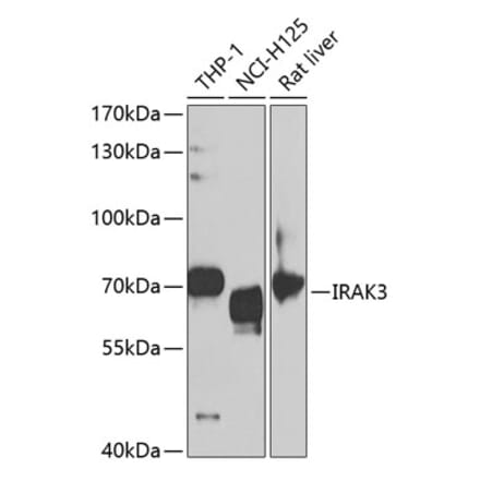 Western Blot - Anti-IRAKM Antibody (A11837) - Antibodies.com