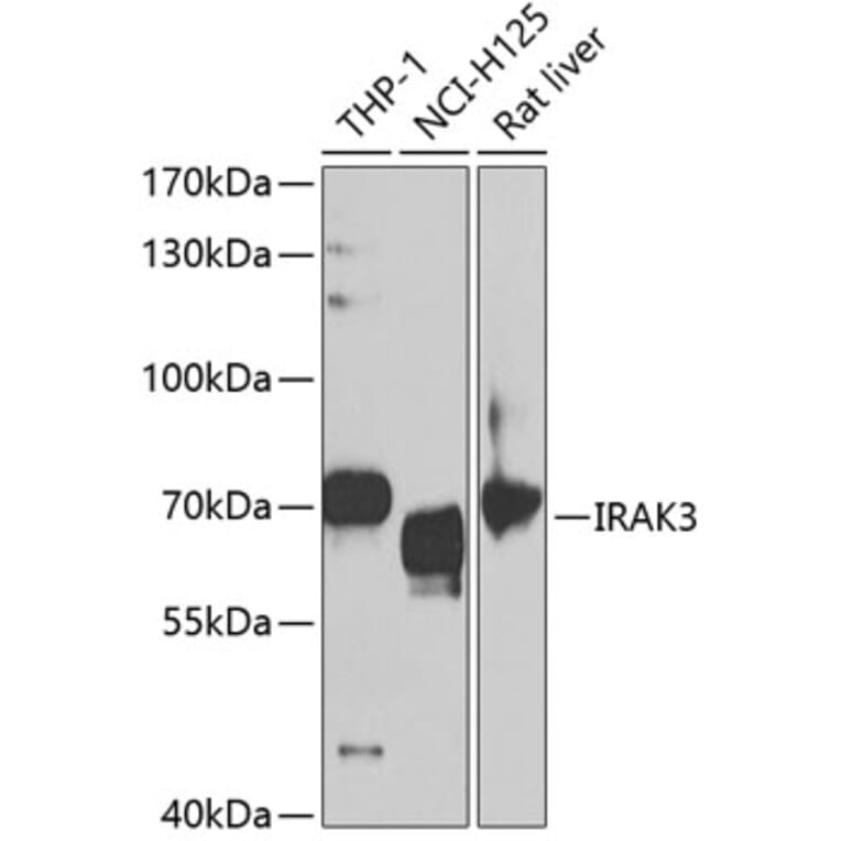 Western Blot - Anti-IRAKM Antibody (A11837) - Antibodies.com
