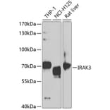 Western Blot - Anti-IRAKM Antibody (A11837) - Antibodies.com