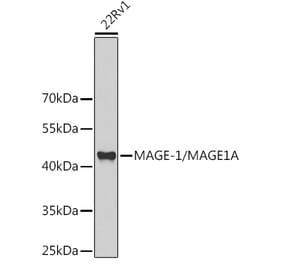 Western Blot - Anti-MAGEA1 Antibody (A11838) - Antibodies.com