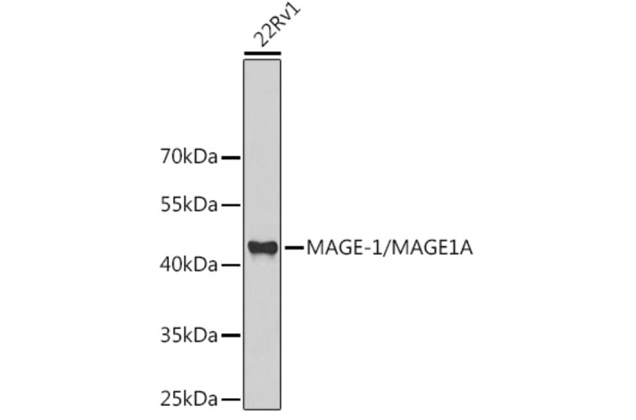 Western Blot - Anti-MAGEA1 Antibody (A11838) - Antibodies.com