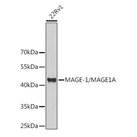 Western Blot - Anti-MAGEA1 Antibody (A11838) - Antibodies.com
