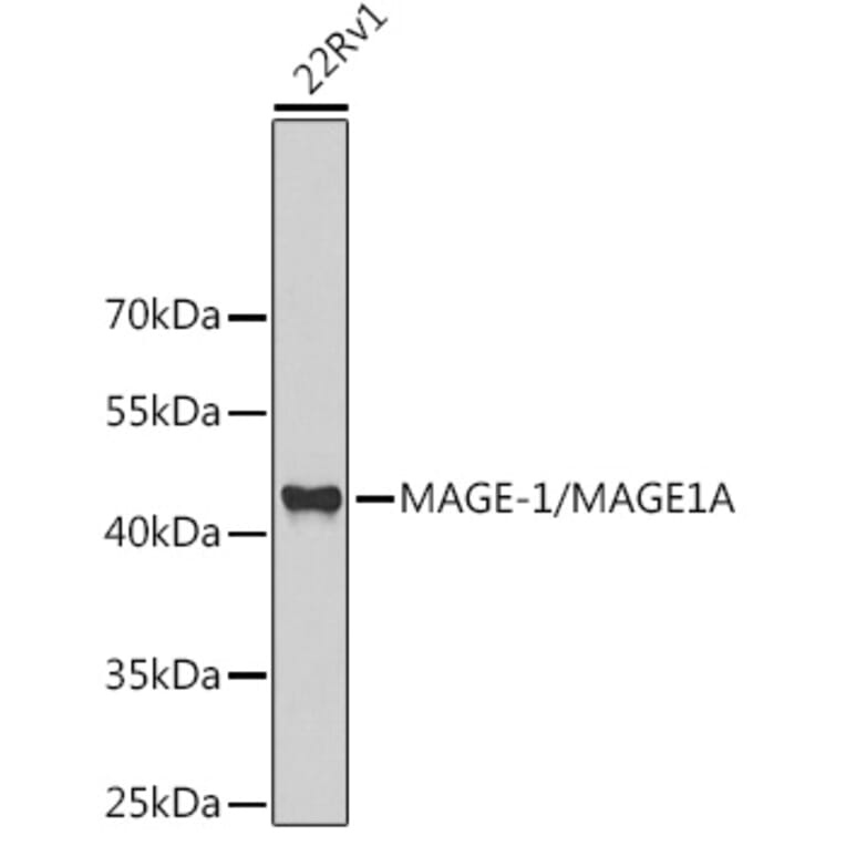 Western Blot - Anti-MAGEA1 Antibody (A11838) - Antibodies.com