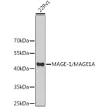 Western Blot - Anti-MAGEA1 Antibody (A11838) - Antibodies.com