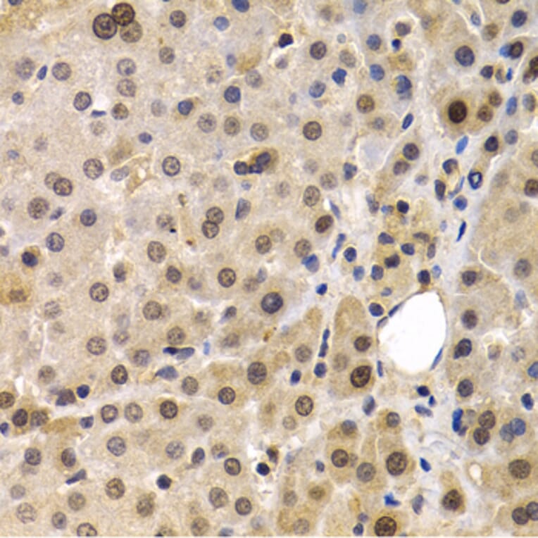 Immunohistochemistry - Anti-MAGEA1 Antibody (A11838) - Antibodies.com