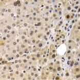 Immunohistochemistry - Anti-MAGEA1 Antibody (A11838) - Antibodies.com