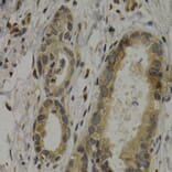 Immunohistochemistry - Anti-MAGEA1 Antibody (A11838) - Antibodies.com