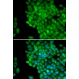Immunofluorescence - Anti-MAGEA1 Antibody (A11838) - Antibodies.com
