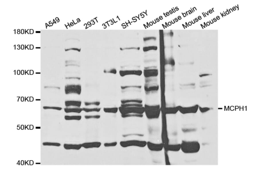 Western Blot - Anti-MCPH1 Antibody (A5472) - Antibodies.com