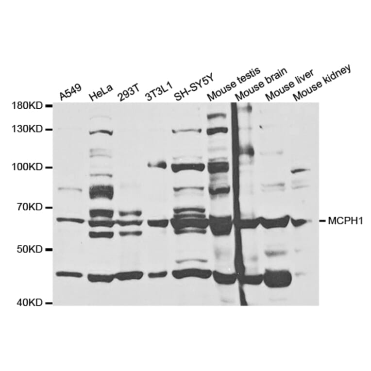 Western Blot - Anti-MCPH1 Antibody (A5472) - Antibodies.com