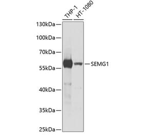 Western Blot - Anti-Semenogelin I Antibody (A11840) - Antibodies.com