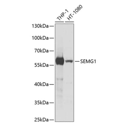 Western Blot - Anti-Semenogelin I Antibody (A11840) - Antibodies.com