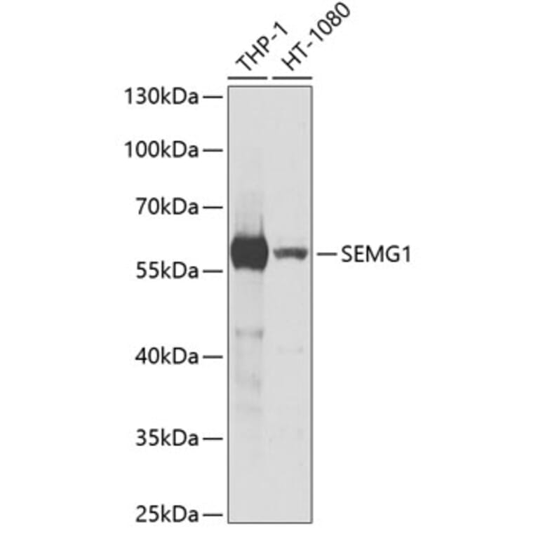 Western Blot - Anti-Semenogelin I Antibody (A11840) - Antibodies.com