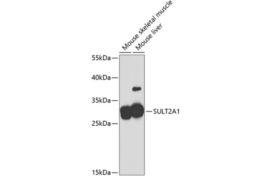Western Blot - Anti-SULT2A1/ST2 Antibody (A11841) - Antibodies.com