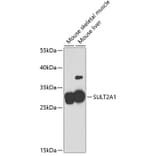 Western Blot - Anti-SULT2A1/ST2 Antibody (A11841) - Antibodies.com