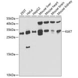 Western Blot - Anti-Kallikrein 7/KLK7 Antibody (A11842) - Antibodies.com