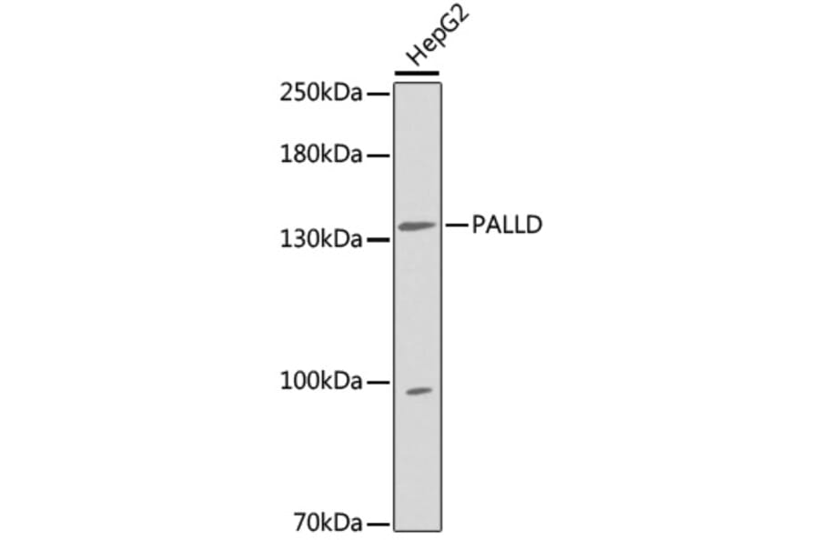Western Blot - Anti-PALLD Antibody (A5529) - Antibodies.com
