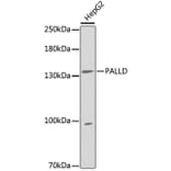 Western Blot - Anti-PALLD Antibody (A5529) - Antibodies.com
