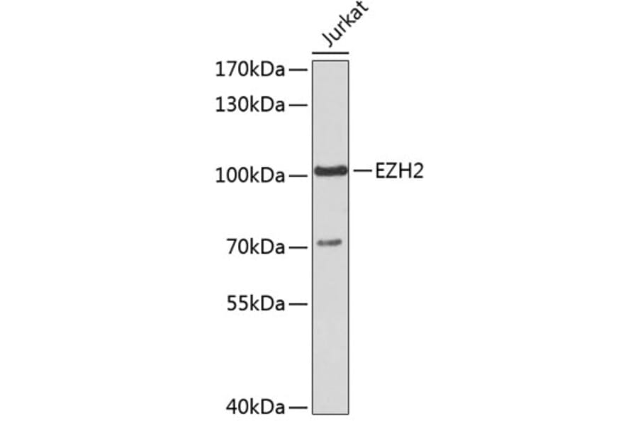 Western Blot - Anti-EZH2 Antibody (A5535) - Antibodies.com