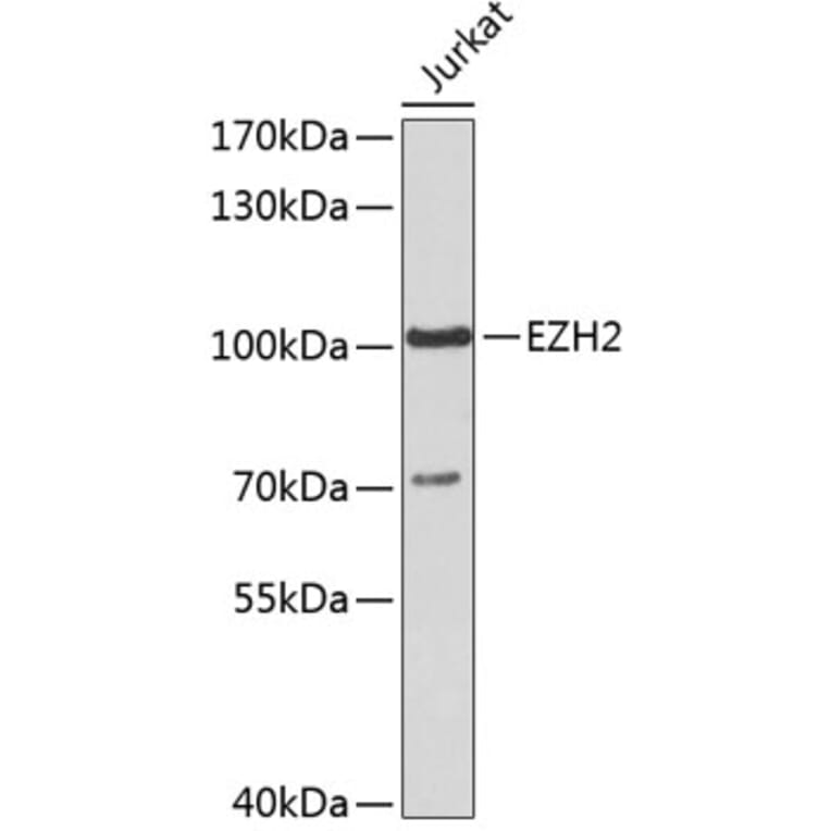 Western Blot - Anti-EZH2 Antibody (A5535) - Antibodies.com