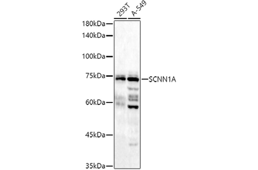 Western Blot - Anti-epithelial Sodium Channel alpha Antibody (A11846) - Antibodies.com