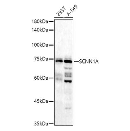 Western Blot - Anti-epithelial Sodium Channel alpha Antibody (A11846) - Antibodies.com