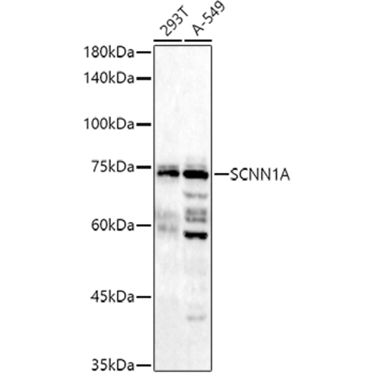 Western Blot - Anti-epithelial Sodium Channel alpha Antibody (A11846) - Antibodies.com