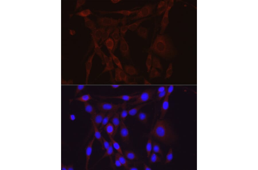 Anti-epithelial Sodium Channel alpha Antibody (A11846)