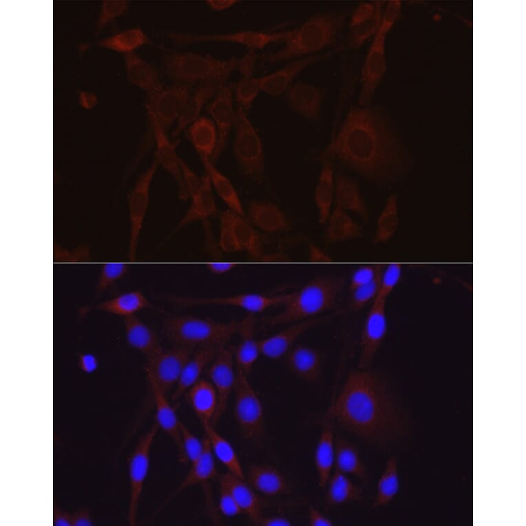 Immunofluorescence - Anti-epithelial Sodium Channel alpha Antibody (A11846) - Antibodies.com