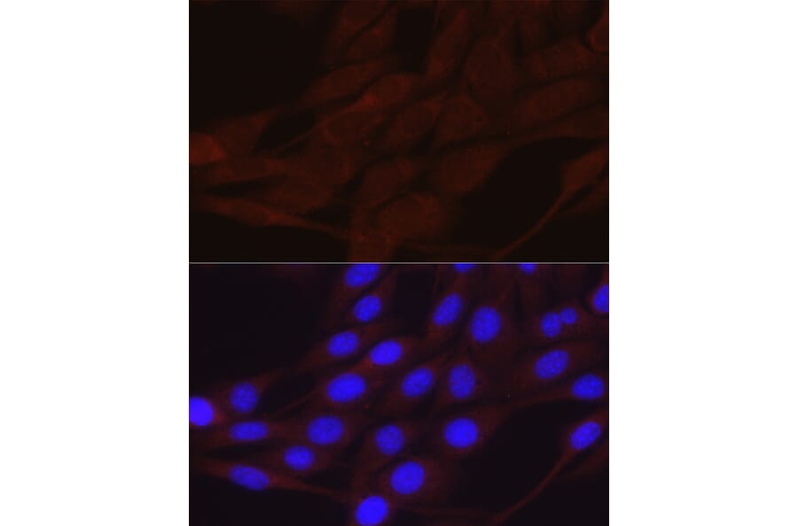 Immunofluorescence - Anti-epithelial Sodium Channel alpha Antibody (A11846) - Antibodies.com