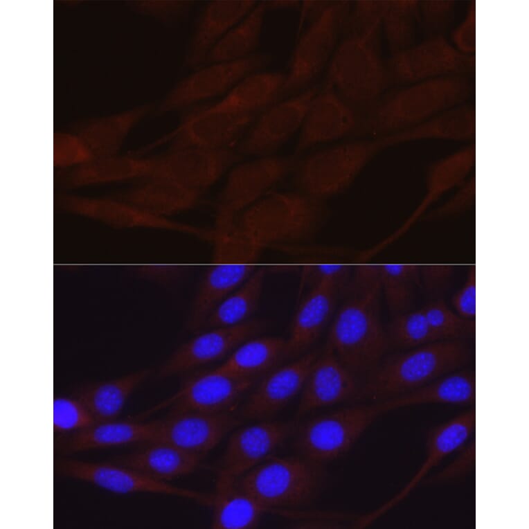 Immunofluorescence - Anti-epithelial Sodium Channel alpha Antibody (A11846) - Antibodies.com