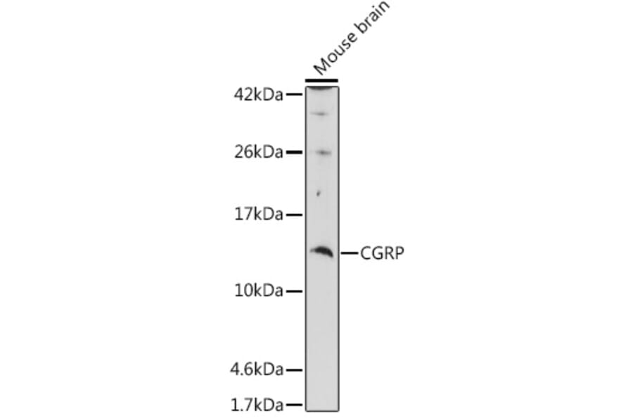 Western Blot - Anti-CGRP-1 Antibody (A11847) - Antibodies.com