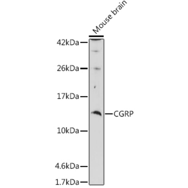 Western Blot - Anti-CGRP-1 Antibody (A11847) - Antibodies.com