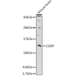 Western Blot - Anti-CGRP-1 Antibody (A11847) - Antibodies.com