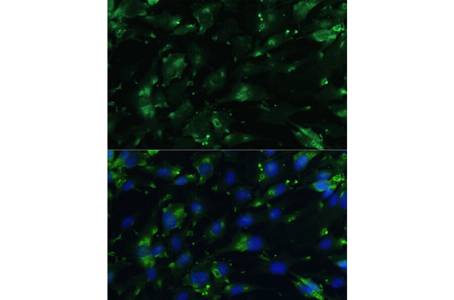 Immunofluorescence - Anti-CGRP-1 Antibody (A11847) - Antibodies.com