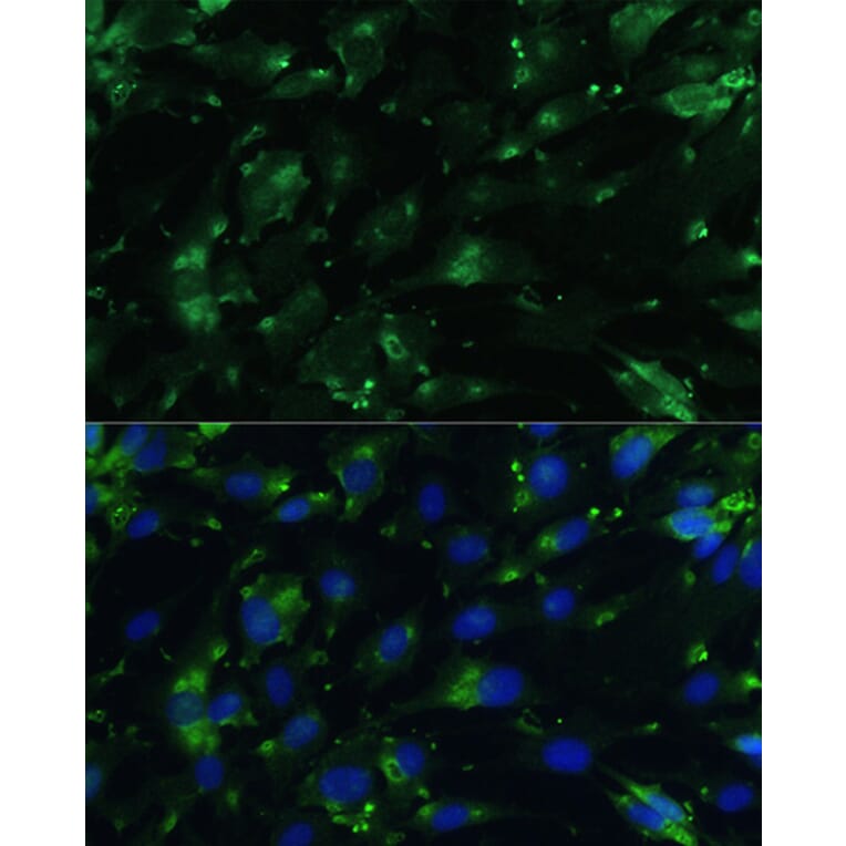 Immunofluorescence - Anti-CGRP-1 Antibody (A11847) - Antibodies.com