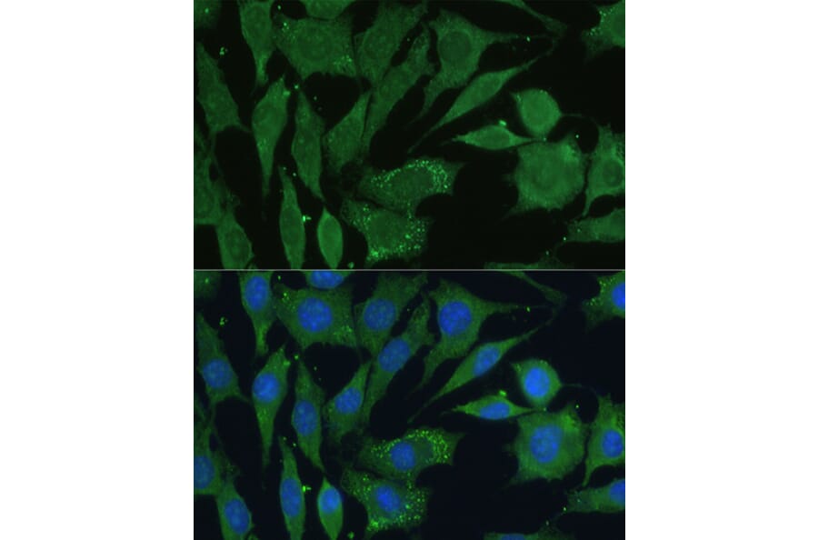 Immunofluorescence - Anti-CGRP-1 Antibody (A11847) - Antibodies.com