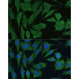 Immunofluorescence - Anti-CGRP-1 Antibody (A11847) - Antibodies.com