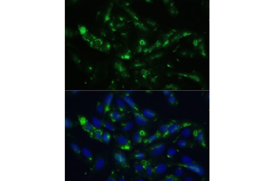 Immunofluorescence - Anti-CGRP-1 Antibody (A11847) - Antibodies.com