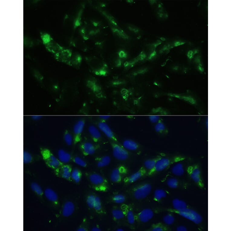 Immunofluorescence - Anti-CGRP-1 Antibody (A11847) - Antibodies.com